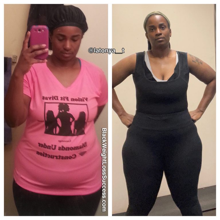 Latonya Lost 59 Pounds Without Surgery